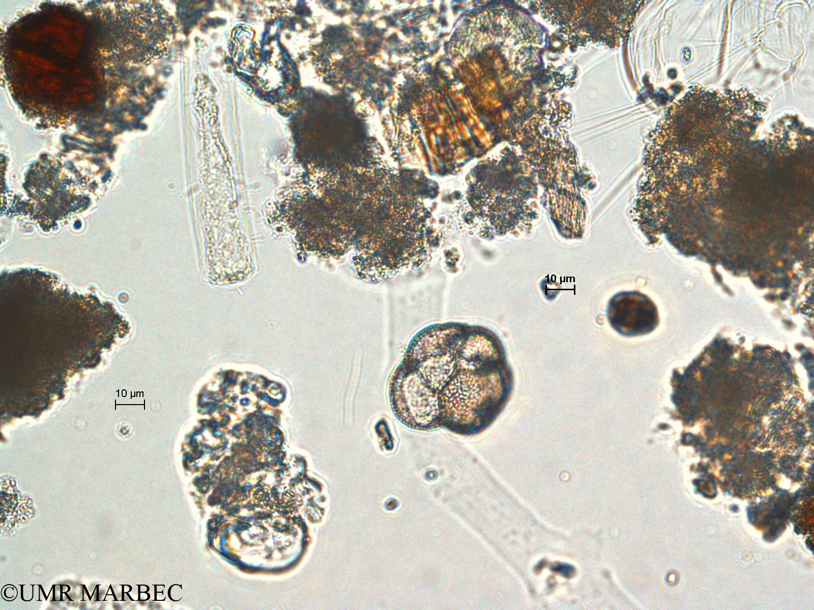 phyto/Scattered_Islands/europa/COMMA April 2011/Foraminifera spp (ancien Foraminifère 1-2(copy).jpg
